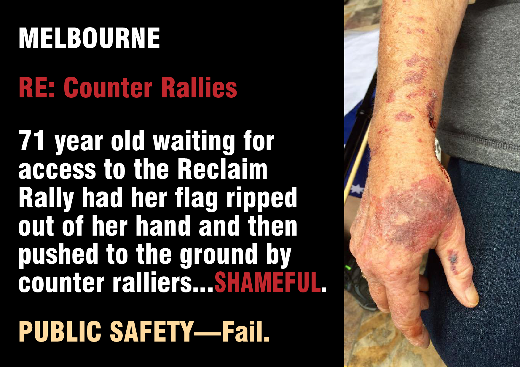 Reclaim Australia Rally- Melbourne FB page—(Confirmed legitimate photo) 